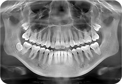 maharjan local dentures