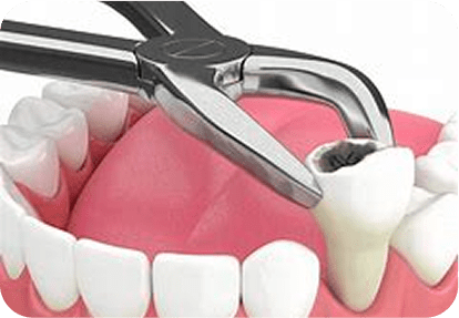 maharjan local dentures