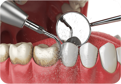 maharjan local dentures