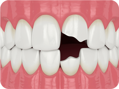 maharjan local dentures