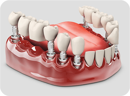 maharjan local dentures