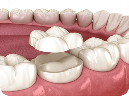 maharjan local dentures