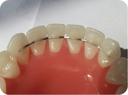 maharjan local denture
