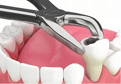 maharjan local denture new dental 03