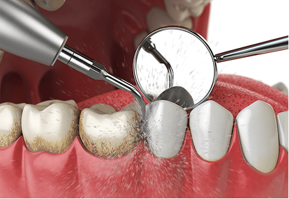 maharjan local denture new dental 05
