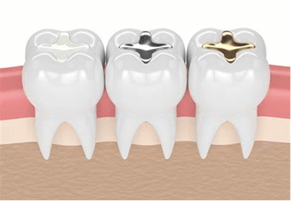 maharjan local denture new dental 07
